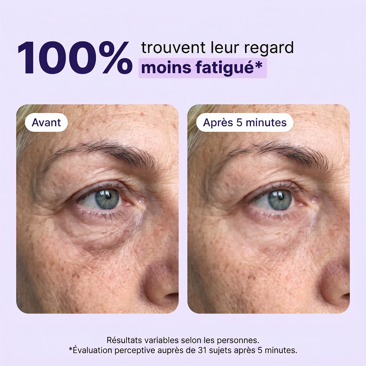 Liftéa — 100% regard moins fatigué avant/après