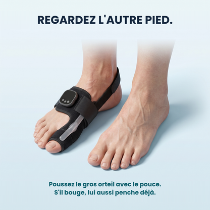 Attelle™ EMS Hallux Valgus